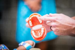 Why Do Front Teeth Get Cavities? Causes, Early Signs, and How to Prevent Them