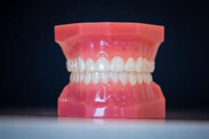 What is the Process of Getting Dentures from a Dentist?