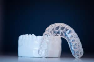 How Long Does It Take to Complete Invisalign Treatment?