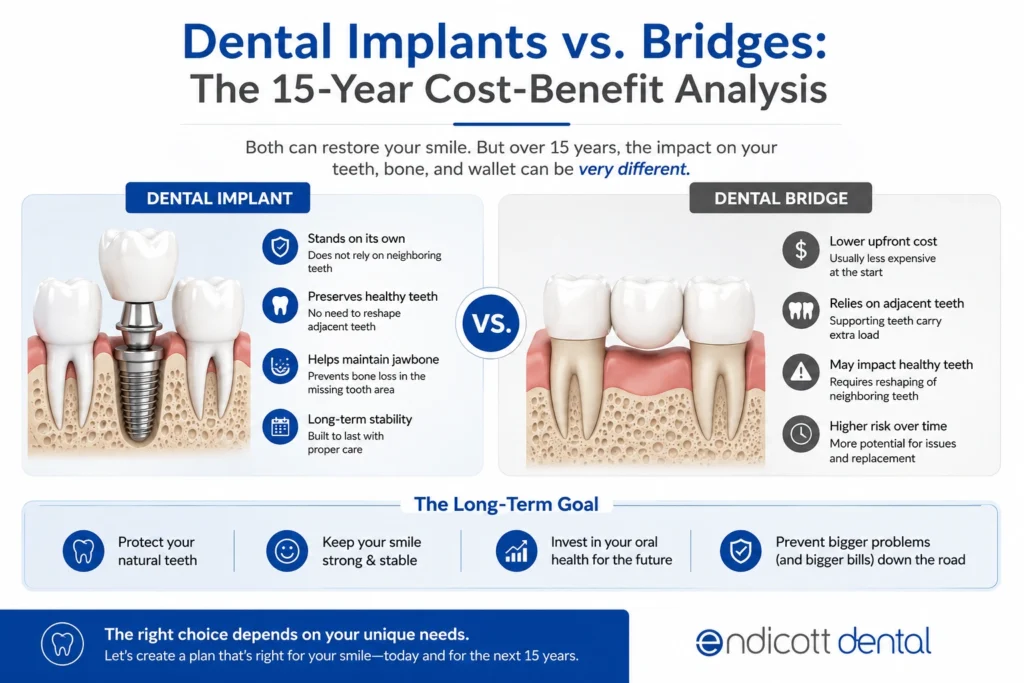 Endicott Dental Implant vs Bridge Infographic Middle Content