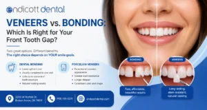 Veneers vs. Bonding: Which Is Right for Your Front Tooth Gap?