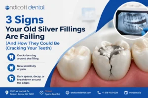3 Signs Your Old Silver Fillings Are Failing (And How They Could Be Cracking Your Teeth)