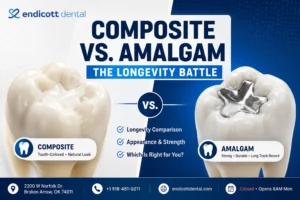 Composite vs. Amalgam Fillings: The Longevity Battle