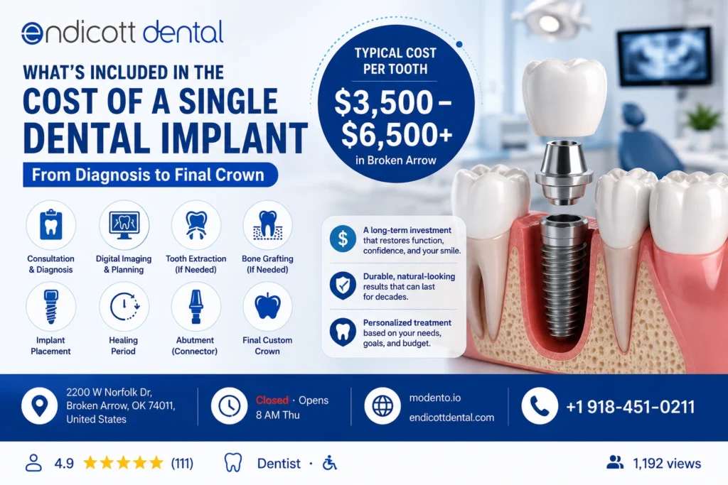 Endicott Dental Implant Middle Content Image