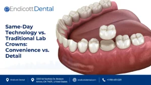 Same-Day Technology vs. Traditional Lab Crowns: Convenience vs. Detail