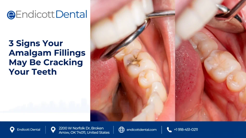 3 Signs your old silver fillings are failing (and how they could be cracking your teeth). 2
