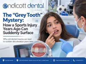 The “Grey Tooth” Mystery: How a Sports Injury Years Ago Can Suddenly Surface
